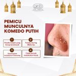 Geda Skincare Solusi Masalah Kulit Anda di Denpasar